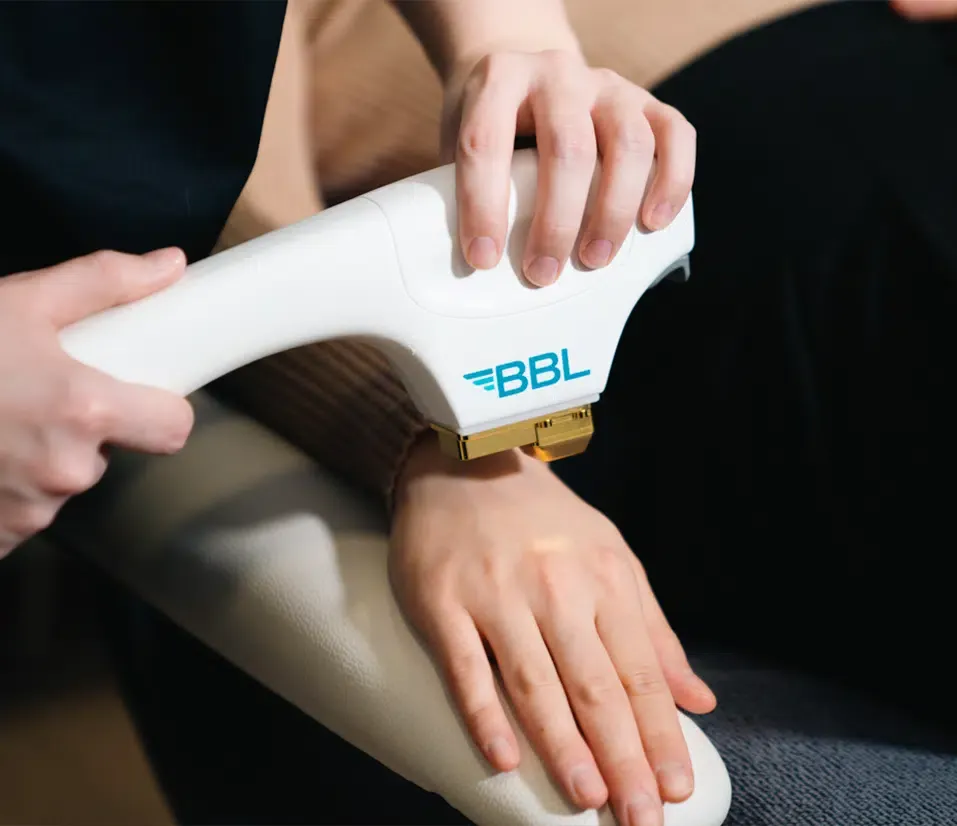 Sciton’s BBL® HERO™ Treatment in Lubbock, TX at Beyond Aesthetics