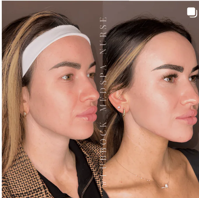Before and After results by treatments at Beyond Aesthetics in Lubbock, TX
